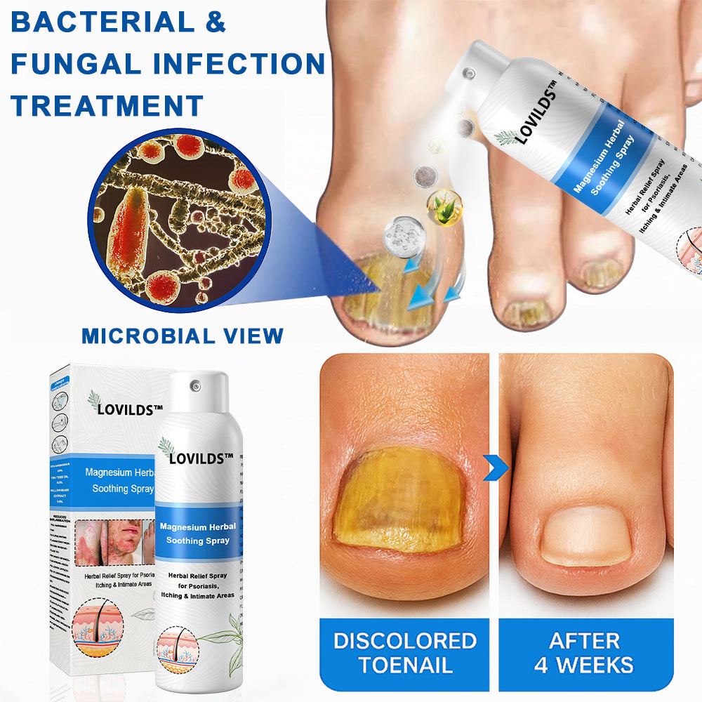 đOfficial Store: LOVILDS⢠Magnesium Herbal Psoriasis Sprayđ