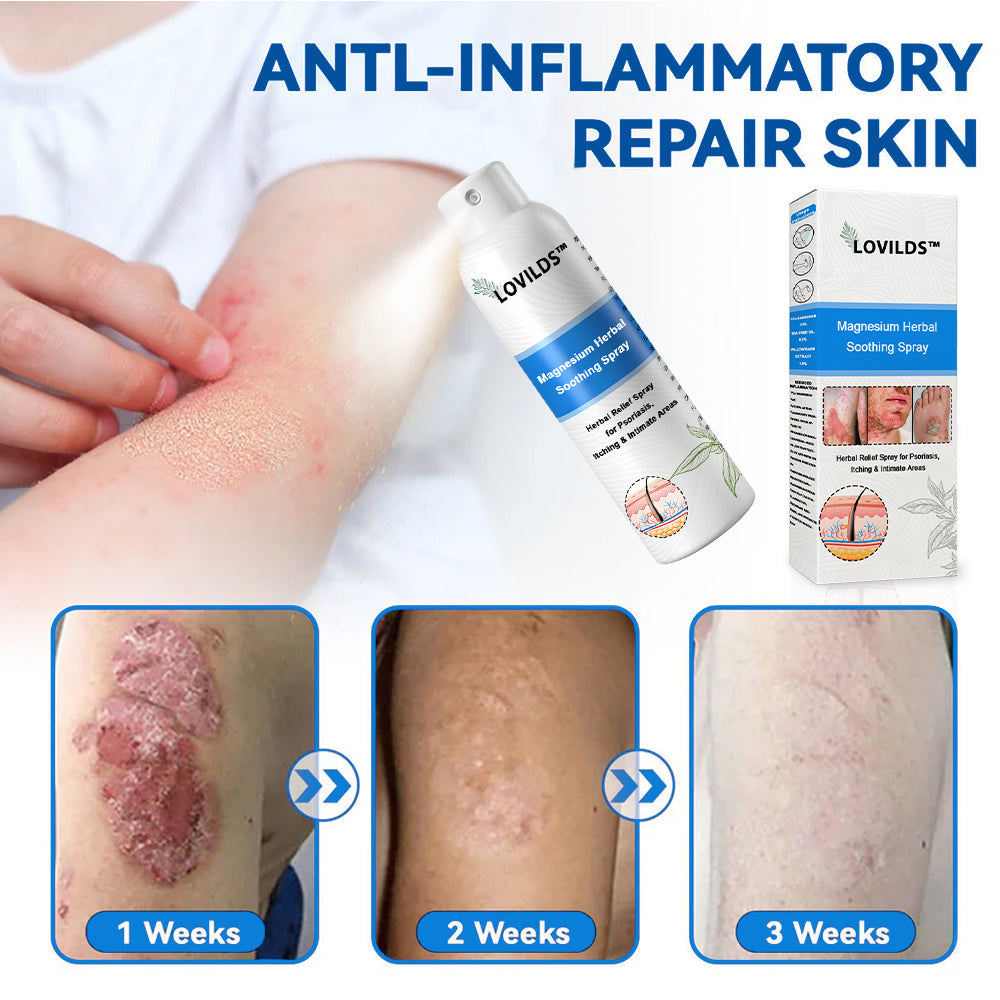 đOfficial Store: LOVILDS⢠Magnesium Herbal Psoriasis Sprayđ