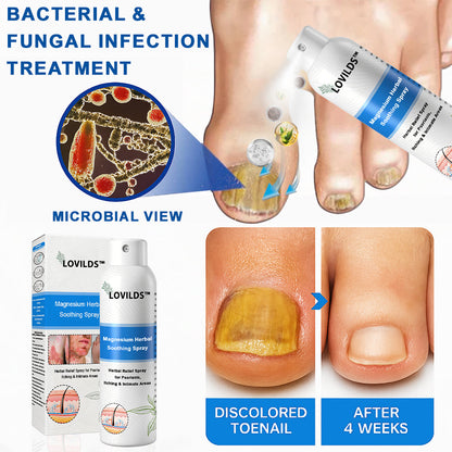 🌈Official Store: LOVILDS™ Magnesium Herbal Psoriasis Spray🚀